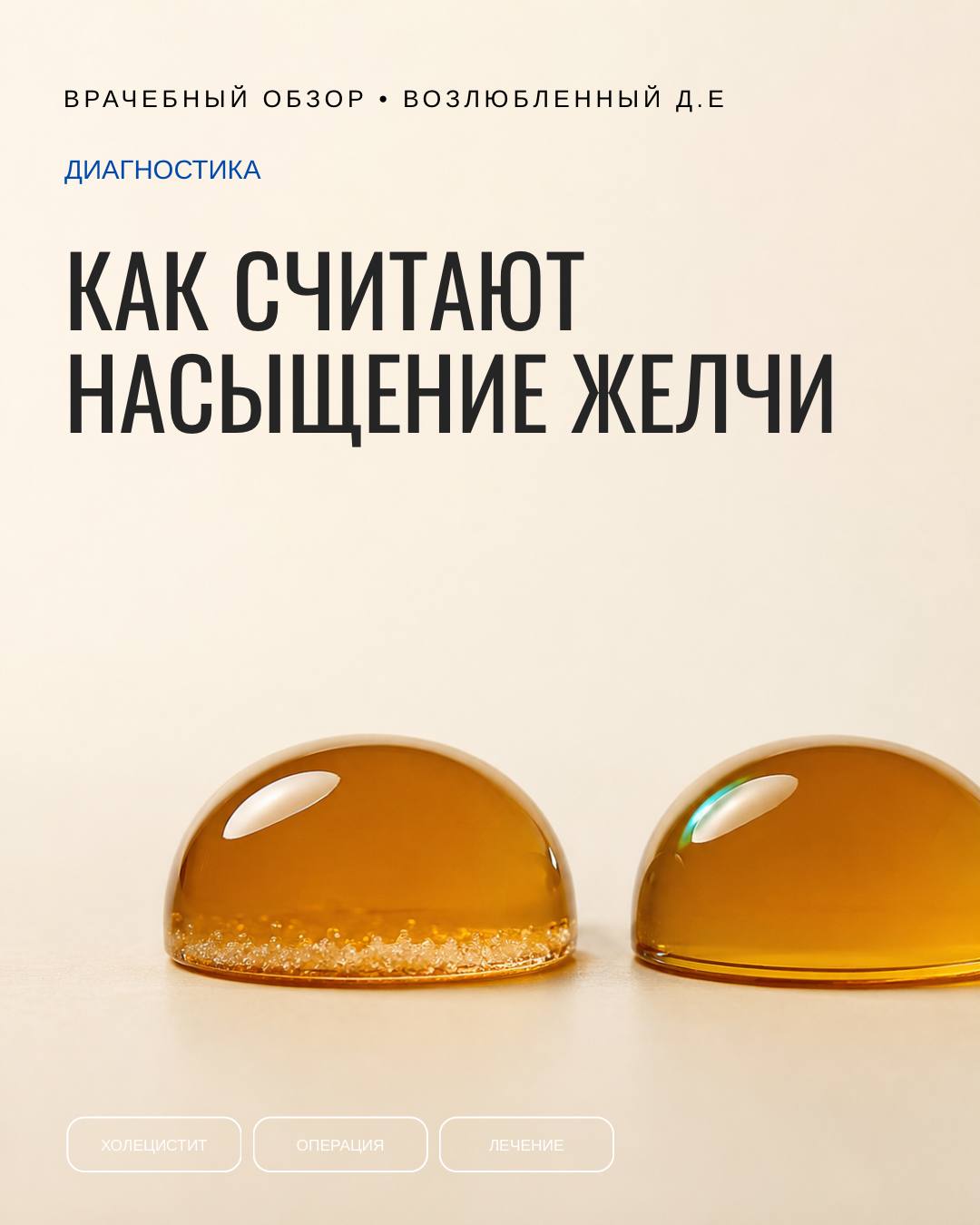 Индекс насыщения — не анализ на камни