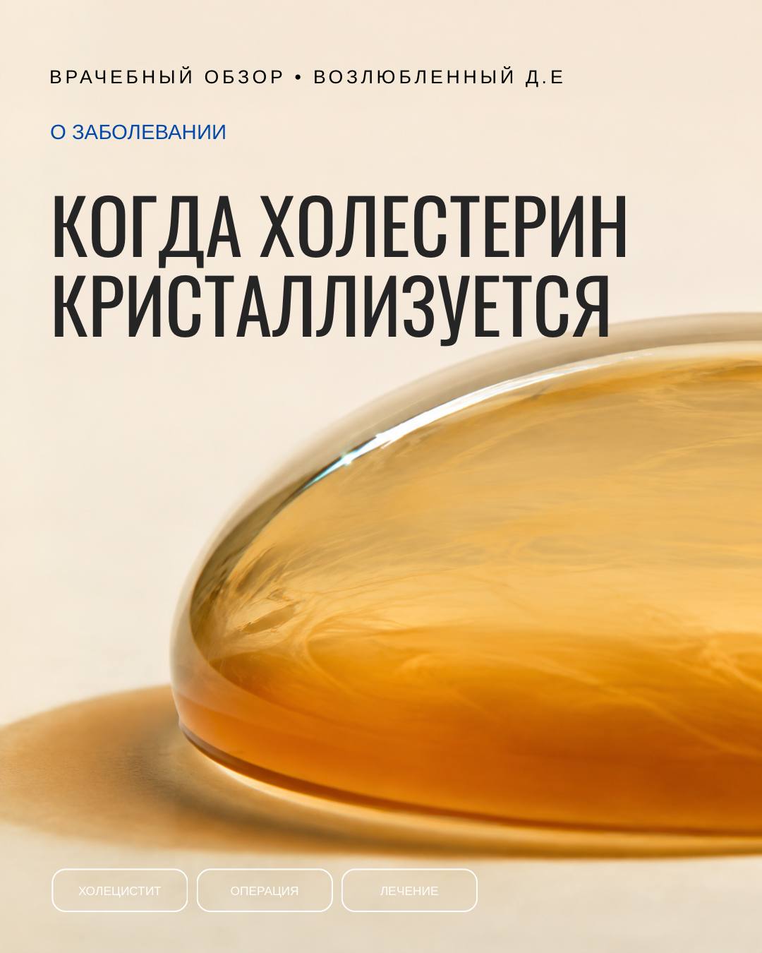 Перенасыщение — ещё не камень