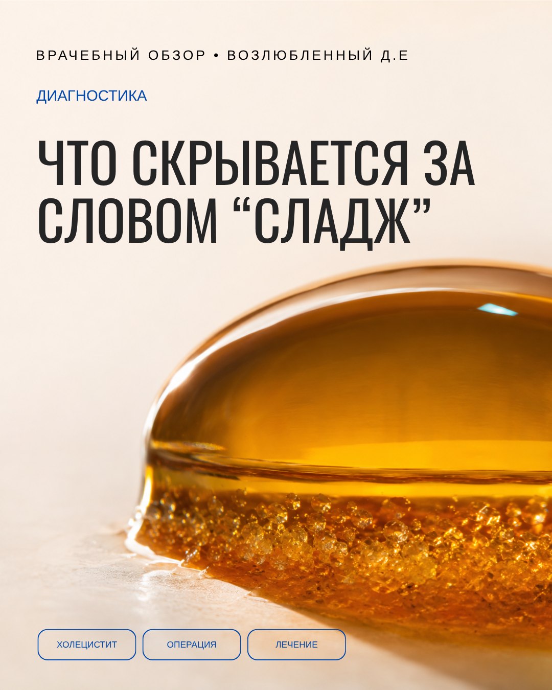Сладж — не микролитиаз