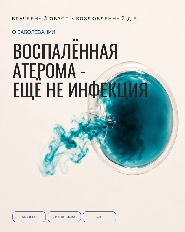 Воспалённая атерома чаще всего не инфицирована — и это меняет всю тактику