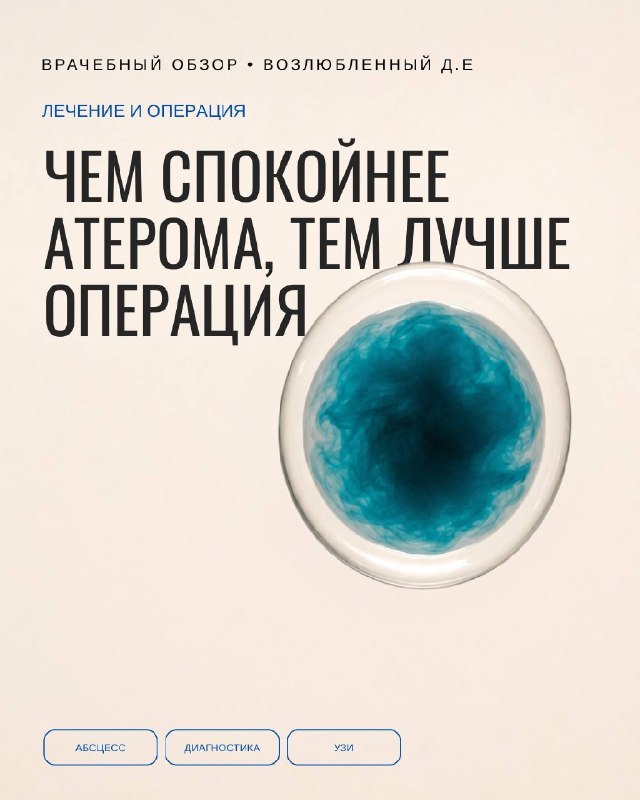 Оперировать атерому надо тогда, когда она спокойна — и в этом весь парадокс профилактики