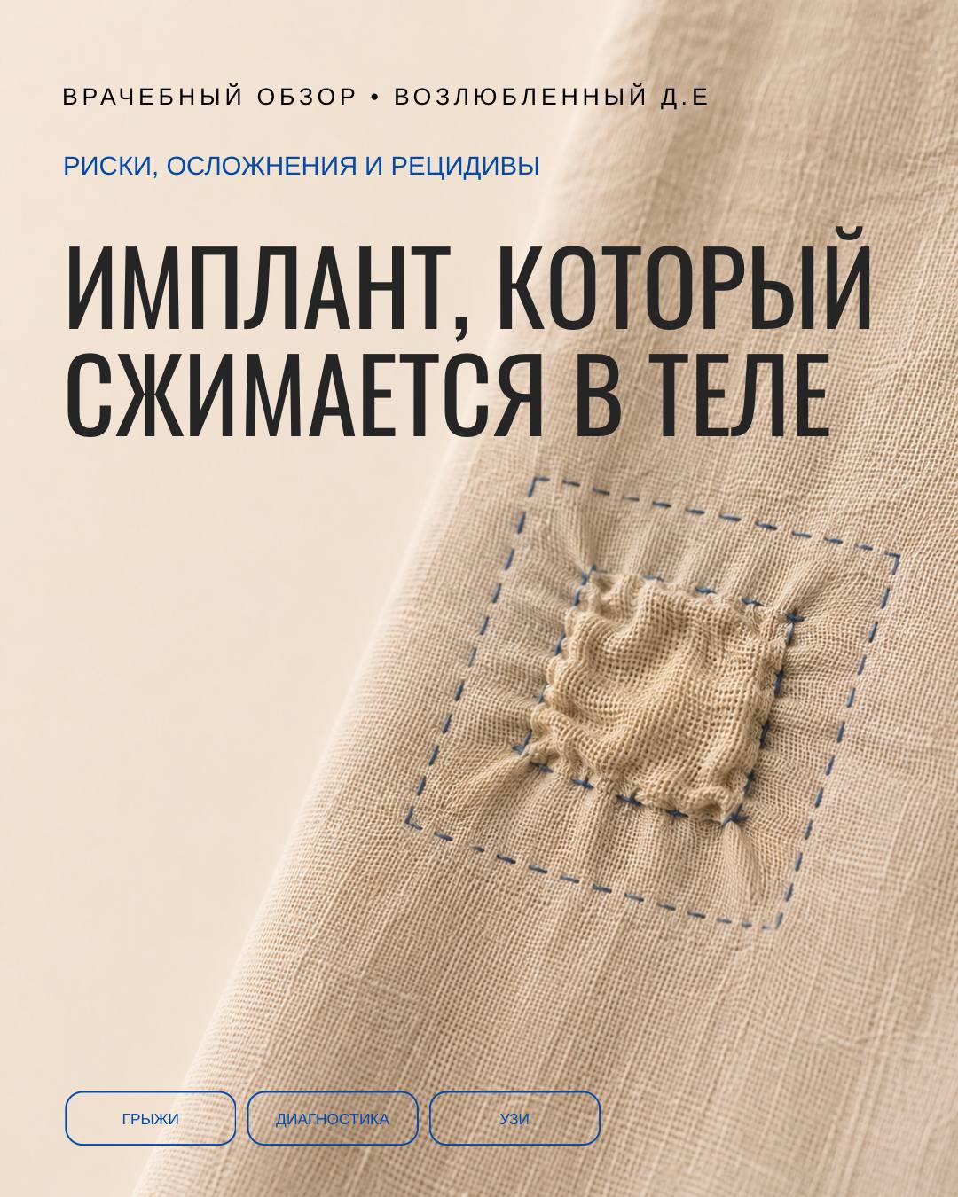 Имплант, который сжимается в теле