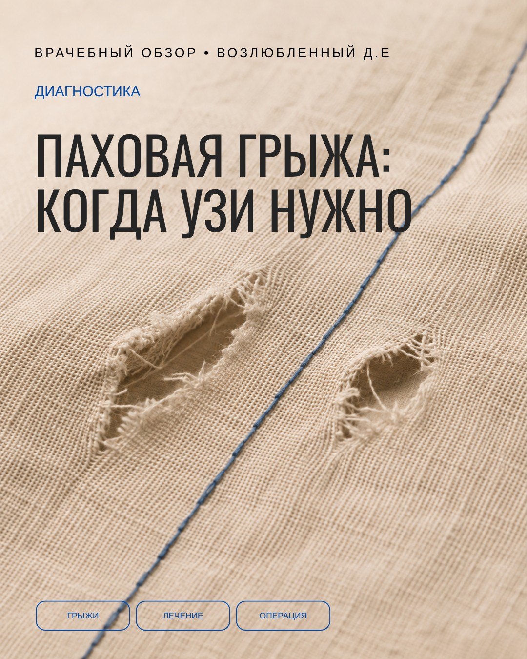 Хорошее УЗИ паха начинается там, где закончился осмотр